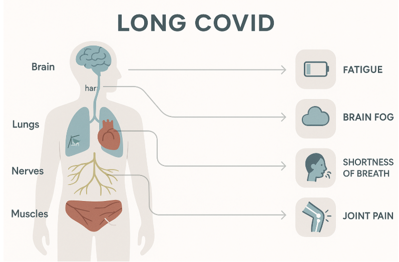 Minimalist infographic showing a human silhouette with color-coded brain, lungs, heart, nerves, and muscles, each linked by arrows to icons representing Long COVID symptoms like fatigue, brain fog, shortness of breath, and joint pain. Clean, educational vector design on a white background.